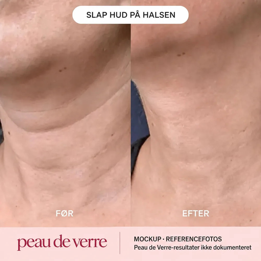 Kollagenmaske til hals & dekolleté